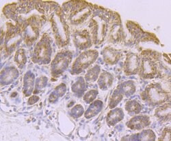 Invitrogen PDHA1 Recombinant Rabbit Monoclonal Antibody (JF996-0) 100 &mu;L;