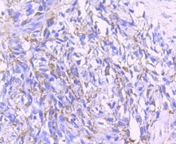 Invitrogen PDHA1 Recombinant Rabbit Monoclonal Antibody (JF996-0) 100 &mu;L;