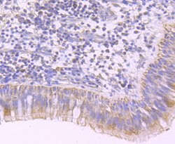 Invitrogen PDHA1 Recombinant Rabbit Monoclonal Antibody (JF996-0) 100 &mu;L;