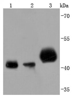 Invitrogen PDHA1 Recombinant Rabbit Monoclonal Antibody (JF996-0) 100 &mu;L;
