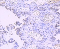 DNMT1 Recombinant Rabbit Monoclonal Antibody (JF09-89) 100 &mu;L | Buy Online | Thermo Scientific | Fisher Scientific