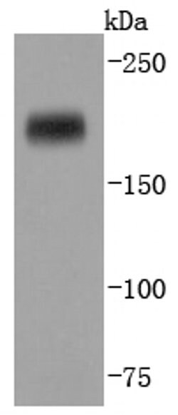 DNMT1 Recombinant Rabbit Monoclonal Antibody (JF09-89) 100 &mu;L | Buy Online | Thermo Scientific | Fisher Scientific