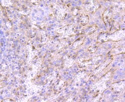 Invitrogen Neutrophil elastase Recombinant Rabbit Monoclonal Antibody (JF098-6)