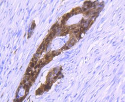 Invitrogen S100P Recombinant Rabbit Monoclonal Antibody (JF95-08) 100 &mu;L | Buy Online | Invitrogen&trade; | Fisher Scientific