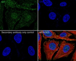 Invitrogen GLI1 Recombinant Rabbit Monoclonal Antibody (JF09-08) 100 &mu;L;