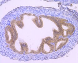 Invitrogen GLI1 Recombinant Rabbit Monoclonal Antibody (JF09-08) 100 &mu;L;