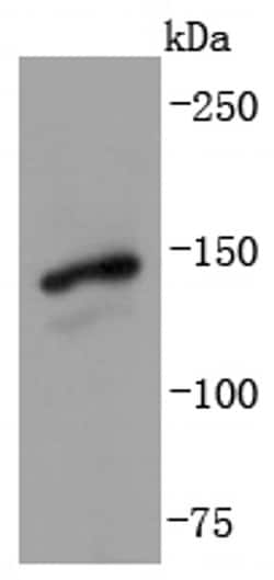 Invitrogen GLI1 Recombinant Rabbit Monoclonal Antibody (JF09-08) 100 &mu;L;