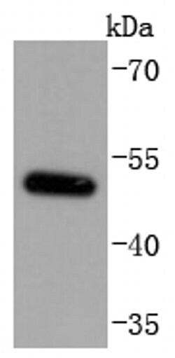 Invitrogen MiTF Recombinant Rabbit Monoclonal Antibody (JF100-01) 100 &mu;L | Buy Online | Invitrogen&trade; | Fisher Scientific