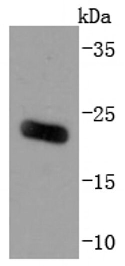 Invitrogen ARF6 Recombinant Rabbit Monoclonal Antibody (JF101-2) 100 &mu;L | Buy Online | Invitrogen&trade; | Fisher Scientific
