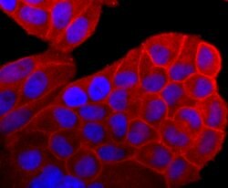 Invitrogen Pan Ras Recombinant Rabbit Monoclonal Antibody (JF10-11) 100