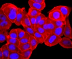 Invitrogen Pan Ras Recombinant Rabbit Monoclonal Antibody (JF10-11) 100