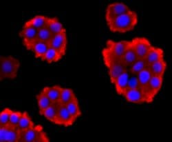 Invitrogen Pan Ras Recombinant Rabbit Monoclonal Antibody (JF10-11) 100