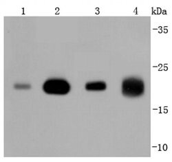 Invitrogen Pan Ras Recombinant Rabbit Monoclonal Antibody (JF10-11) 100