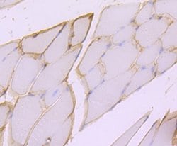 Invitrogen Dystrophin Recombinant Rabbit Monoclonal Antibody (JF1-022)