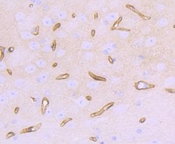 Invitrogen Dystrophin Recombinant Rabbit Monoclonal Antibody (JF1-022)