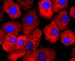 Invitrogen SERCA2 ATPase Recombinant Rabbit Monoclonal Antibody (JM10-20)