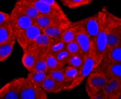Invitrogen SERCA2 ATPase Recombinant Rabbit Monoclonal Antibody (JM10-20)