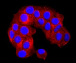 Invitrogen SERCA2 ATPase Recombinant Rabbit Monoclonal Antibody (JM10-20)