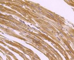 Invitrogen SERCA2 ATPase Recombinant Rabbit Monoclonal Antibody (JM10-20)