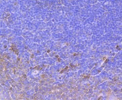 Invitrogen SERCA2 ATPase Recombinant Rabbit Monoclonal Antibody (JM10-20)