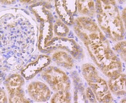 Invitrogen SERCA2 ATPase Recombinant Rabbit Monoclonal Antibody (JM10-20)