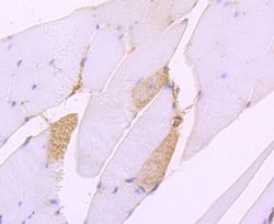 Invitrogen SERCA2 ATPase Recombinant Rabbit Monoclonal Antibody (JM10-20)