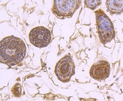 Invitrogen SERCA2 ATPase Recombinant Rabbit Monoclonal Antibody (JM10-20)