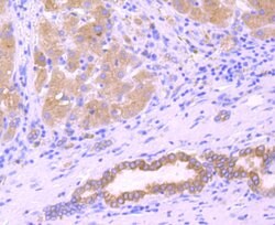 Invitrogen SERCA2 ATPase Recombinant Rabbit Monoclonal Antibody (JM10-20)