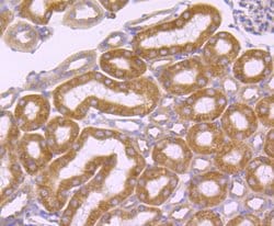 Invitrogen SERCA2 ATPase Recombinant Rabbit Monoclonal Antibody (JM10-20)