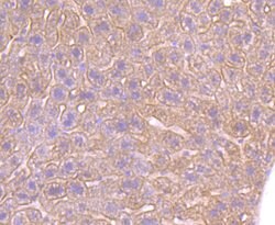 Invitrogen beta-2 Adrenergic Receptor Recombinant Rabbit Monoclonal Antibody