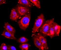 Invitrogen ADAM17 Recombinant Rabbit Monoclonal Antibody (JM10-35) 100