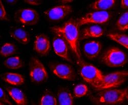 Invitrogen ADAM17 Recombinant Rabbit Monoclonal Antibody (JM10-35) 100