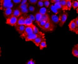 Invitrogen ADAM17 Recombinant Rabbit Monoclonal Antibody (JM10-35) 100