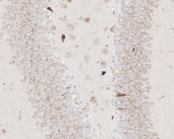 Invitrogen ADAM17 Recombinant Rabbit Monoclonal Antibody (JM10-35) 100