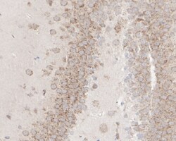 Invitrogen ADAM17 Recombinant Rabbit Monoclonal Antibody (JM10-35) 100