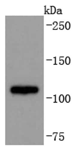 Invitrogen ADAM17 Recombinant Rabbit Monoclonal Antibody (JM10-35) 100