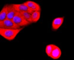Invitrogen Ub-K63 Recombinant Rabbit Monoclonal Antibody (JM09-67) 100
