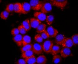 Invitrogen Ub-K63 Recombinant Rabbit Monoclonal Antibody (JM09-67) 100