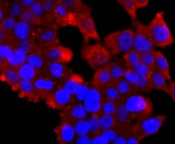 Invitrogen Ub-K63 Recombinant Rabbit Monoclonal Antibody (JM09-67) 100
