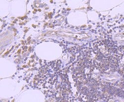 Invitrogen Ub-K63 Recombinant Rabbit Monoclonal Antibody (JM09-67) 100