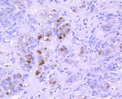 Invitrogen Ub-K63 Recombinant Rabbit Monoclonal Antibody (JM09-67) 100
