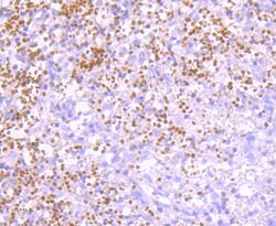 Invitrogen Ub-K63 Recombinant Rabbit Monoclonal Antibody (JM09-67) 100