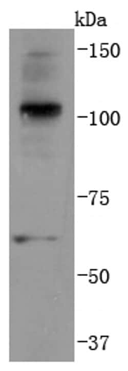 Invitrogen Ub-K63 Recombinant Rabbit Monoclonal Antibody (JM09-67) 100