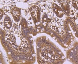 Invitrogen Laminin beta-1 Recombinant Rabbit Monoclonal Antibody (JM099-03) 100 &mu;L | Buy Online | Invitrogen&trade; | Fisher Scientific