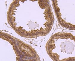 Invitrogen Laminin beta-1 Recombinant Rabbit Monoclonal Antibody (JM099-03) 100 &mu;L | Buy Online | Invitrogen&trade; | Fisher Scientific