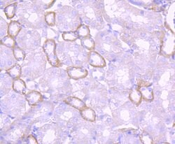 Invitrogen Laminin beta-1 Recombinant Rabbit Monoclonal Antibody (JM099-03) 100 &mu;L | Buy Online | Invitrogen&trade; | Fisher Scientific