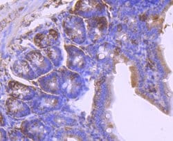 Invitrogen&trade;&nbsp;Laminin beta-1 Recombinant Rabbit Monoclonal Antibody (JM099-03)