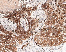 Neural/Glial Antigen 2 (NG2) Recombinant Rabbit Monoclonal Antibody (JM10-13):Antibodies,