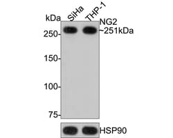 Neural/Glial Antigen 2 (NG2) Recombinant Rabbit Monoclonal Antibody (JM10-13):Antibodies,
