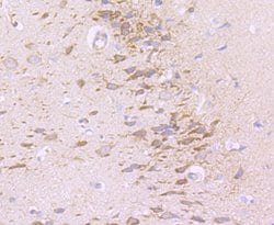 Neural/Glial Antigen 2 (NG2) Recombinant Rabbit Monoclonal Antibody (JM10-13):Antibodies,